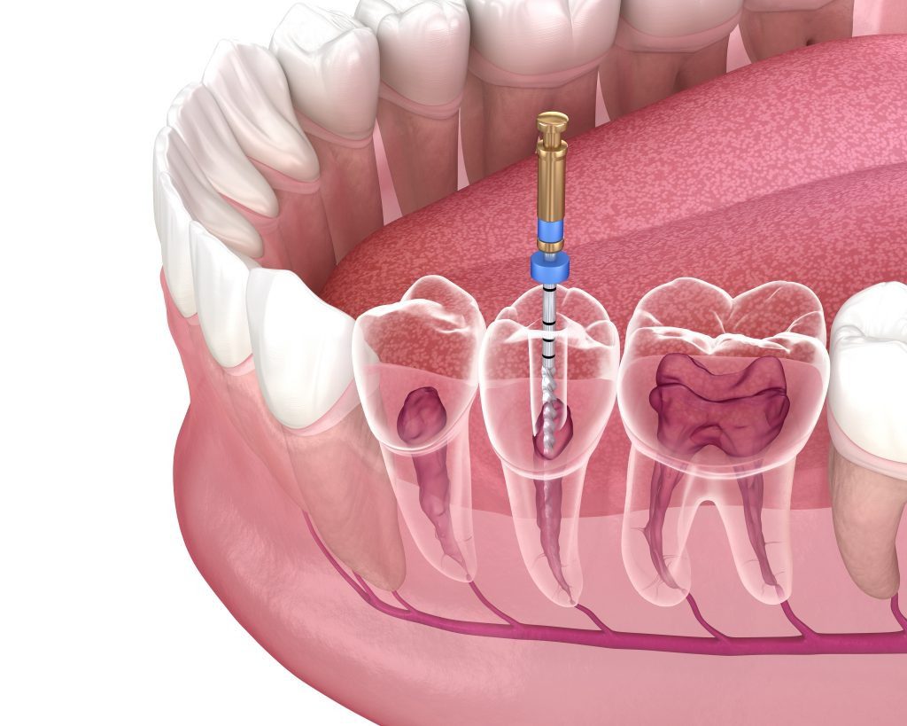 انتخاب مرکز مناسب؛ چرا دندانپزشکی ماهان را انتخاب کنیم؟