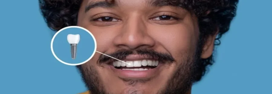 سن مناسب ایمپلنت دندان