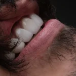 کامپوزیت دندان اقساطی در تهران: چگونه بدون دغدغه پرداخت کنیم