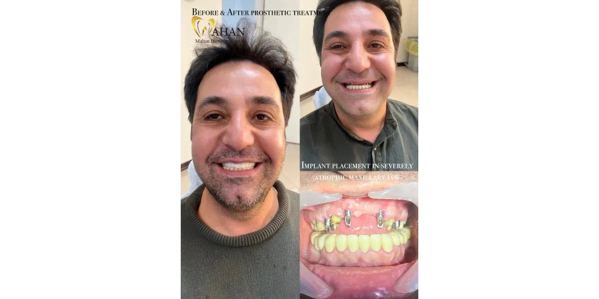 بهترین متخصص های پریودنتیست دیجیتال در کرج