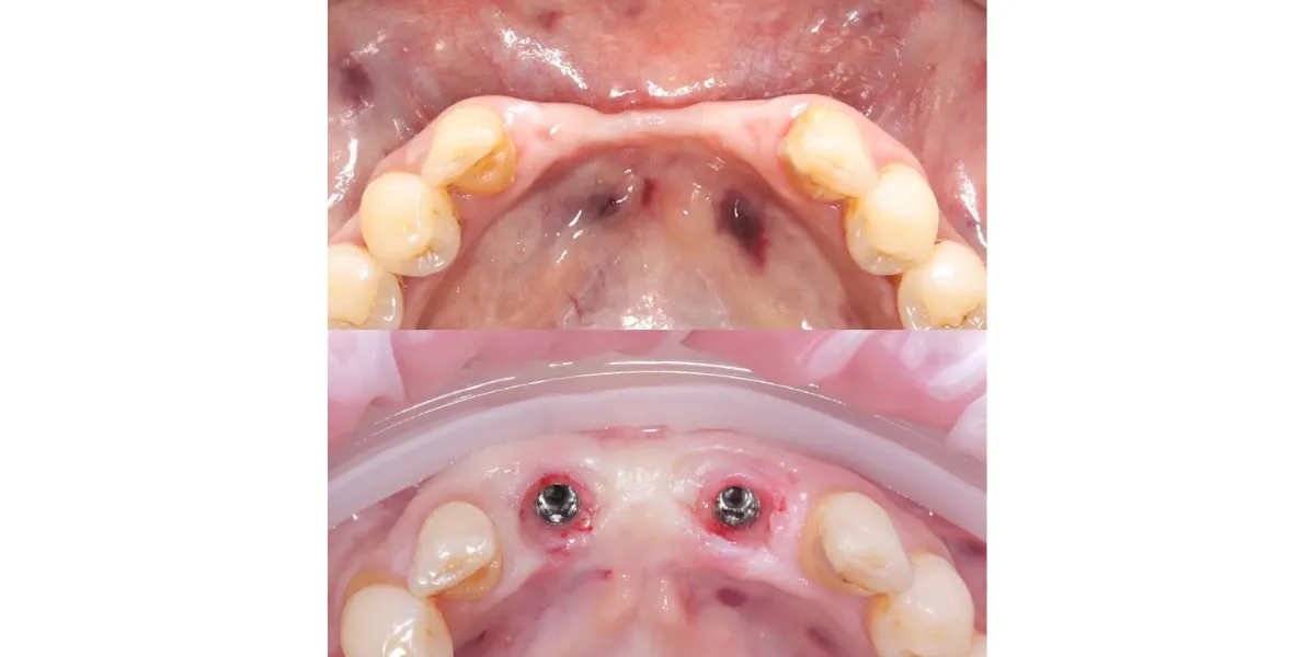 بهترین متخصص های پریودنتیست دیجیتال در کرج