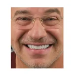 خط لبخند چیست و چگونه در طراحی کامپوزیت تأثیر دارد؟