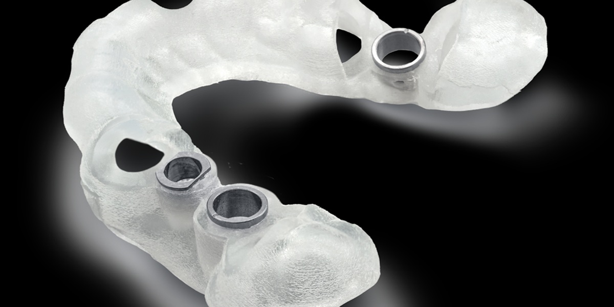 اسکنر داخل دهانی در کامپوزیت و ایمپلنت